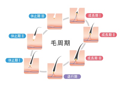 足立区のaga 男性型脱毛症 の治療はみずき皮膚科クリニック