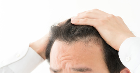 足立区のaga 男性型脱毛症 の治療はみずき皮膚科クリニック